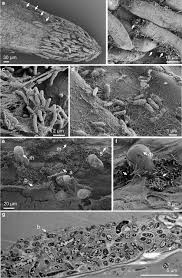 Image result for Rhizobium radiobacter, syn. Agrobacterium tumefaciens