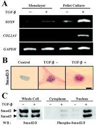 Emisija nije dostupna u državi. Smad3 Induces Chondrogenesis Through The Activation Of Sox9 Via Creb Binding Protein P300 Recruitment Boxs Journal Of Biological Chemistry