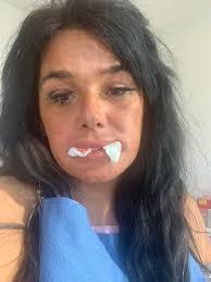 Positive Experience with Dental Implants and Bridges at Tyson's Corner