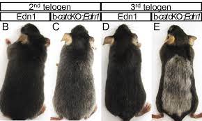 The retina at the back of the eye may also be affected. A Cure For Gray Hair And Vitiligo Appears To Work In Mouse Studies
