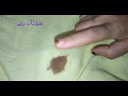 طريقة ازالة بقع الشيكولاتة من الملابس مهما كانت صعبة او قديمة وبكل سهولة Youtube