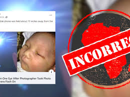 No evidence that camera flashes damage babies' eyes