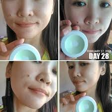 Black And White Bleaching Cream Reviews Pin On Blogs To Follow