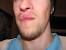 Nose Hair Diagram