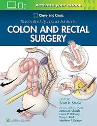 Most colon polyps are harmless. Colon Lexikon Der Biologie