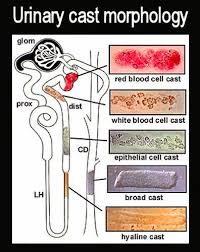 Image result for Urinary Cast