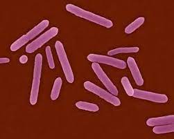 Clostridium tetani is a common soil bacterium and the causative agent of tetanus. Clostridium Tetani Microbewiki