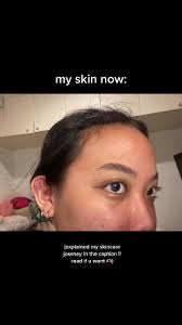 My Skincare Journey: Before and After Photos