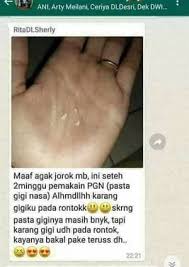 Perontok Karang Gigi Ampuh Nasa Pasta Odol Pemutih Gigi Asli 100 Original Bpom Ampuh Memutihkan Gigi Perontok Karang Gigi Kuning Ampuh Pembersih Karang Gigi Penghilang Karang Gigi Pasta Gigi Nasa Obat