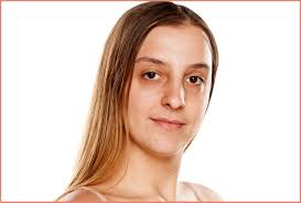 Home Remedies For Dark Circles Under Eyes Emedihealth Apply a mixture of lemon and tomato juice on the dark circles twice a day.