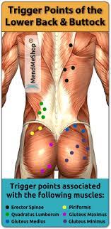 I'm back with an update and more questions. Trigger Points Hip Back