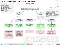 Coronary Anatomy On Ecg Localizing Ischemia Calgary Guide In 2020 Coronary Anatomy Medical Facts