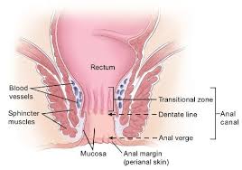 Lumpectomy margins are the rim of normal tissue surrounding the cancer tumor that is often removed with the tumor during the surgery to ensure the cancer is completely gone. What Is Anal Cancer