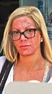 Sharon Osbourne's Ozempic Transformation #SharonOsbourne #osbourne  #transformation #ozempic