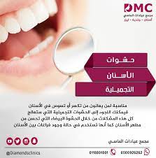 الحشوات التجميلية مناسبة لمن يعانون من تكسر أو تسوس في الأسنان فيمكنك اللجوء إلى الحشوات التجميلية التي ستعالج كل هذه المشكلات من teeth health gag health