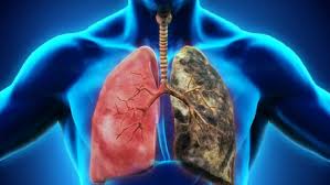 টানা কাশি কি ক্যানসার নাকি সাধারণ ফ্লু বিশেষজ্ঞের পরামর্শে জানুন আসল সত্য