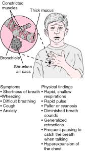 Asthma Attack You Can Find Out More Details At The Link Of The Image Asthma Treatment Asthma Attacks Asthma Relief