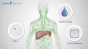 Patientenfilm Zur Chronischen Lymphatischen Leukamie Cll