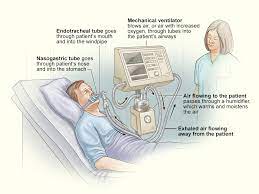 You usually breathe out the air on your own, but sometimes the ventilator does this for you too. Ventilator Ventilator Support Nhlbi Nih