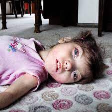 Baby jane doe was identified last year as alisha ann heinrich. Meet Gabby Williams The 9 Year Old Baby Who Will Never Grow Old Mirror Online