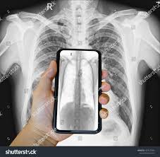 Can you imagine your surprise if gregory house got your case and became your doctor? Smartphone Technology Is Used To Scan The X Ray Of The Chest And Lungs Of Patients Receiving Pm2 5 Dust Medical Smartphone Technology Smartphone Photo Editing