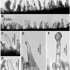 Although the term trichomes generally refers to outgrowths ranging from small hairs to larger outgrowths like thorns, it is typically used to refer to the tiny hairs that can be seen emerging from the surfaces of leaves and other epidermal surfaces of plants. Light Microscope Images Showing Different Trichomes Within Minuartia Download Scientific Diagram