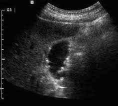 Pin On Radio Abdomen Pelvis