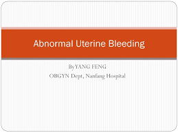 Abnormal Uterine Bleeding Ppt Download