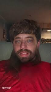 What ideas can help with hair loss?