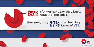 This is where clots tend to originate because gravity can cause. World Thrombosis Day Venous Thromboembolism Vte