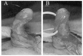 Image result for Chordee