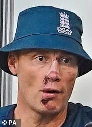 Freddie Flintoff opens up 'learning to accept' the scars of his near-fatal  Top Gear crash as footage is seen for the first time