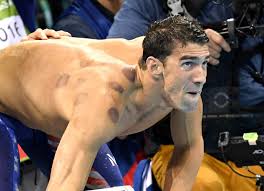 Sie kannte keinen wirklichen ruhm, bis sie die freundin und die zweite frau von wurde esel star bam margera in einer dramatischen hochzeitszeremoniedas fand im oktober 2013 in reykjavik, island, statt.nicole knüpfte mit ihrem neuen ehemann zusammen mit seiner musikcrew den bund. Waarom Michael Phelps Ronde Vlekken Op Zijn Lichaam Heeft