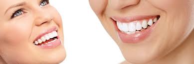 Shape and size of teeth; Cosmetic Dentist Williamsburg Va Cosmetic Dental Procedures