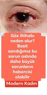 Buna Cok Sasiracaksiniz Saglik Dogal Saglik Ev Yapimi Cilt Bakimi