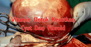 Ambil makanan yang bertindak sebagai anti estrogen. Vitamin Untuk Kecutkan Cyst Dan Fibroid