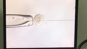 Ivf is one of the most enhanced and productive treatment in india to hit upon this government hospital is situated in jawahar lal nehru marg, in delhi. Epf S Account 2 Will Allow Withdrawals For Subfertility Treatments Codeblue