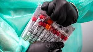 Fragen zu gesundheit und quarantäne beantworten wir montags von 8 bis 20 uhr und dienstags bis sonntags von 9 bis 15 uhr. Gesundheit Berlin 923 Neue Corona Falle In Hessen Inzidenz Weiter Gestiegen Gesundheit Sz De