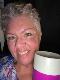 We're pulling for you, WRAL Mike Maze!