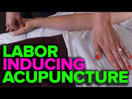 Labor Induction Acupuncture Acupressure And Stress Relieving Massage Therapy Childbirth Tips
