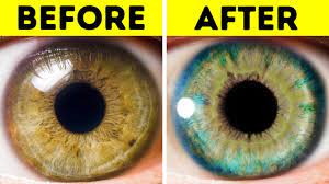 This makes it difficult to see where a blue shade become gray, where green approaches hazel or where brown turns to amber. 7 Things That Can Change Your Eye Color Youtube
