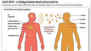 Megállapodást írt alá kuba iránnal arról, hogy átadja az ázsiai országnak a koronavírus ellen fejlesztés alatt álló, legelőrehaladottabb. Koronavirus Egyre Tobb A Kulfoldi Megbetegedes Portfolio Hu