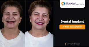 Transform Your Smile with Dental Implants