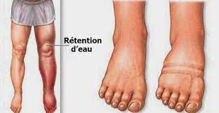 Quel produit détox choisir pour drainer le corps ? Voici Comment Evacuer La Retention D Eau De Votre Corps Retention D Eau Comment Degonfler Conseils Pour Perdre Du Poids