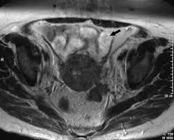► hip ► pelvis ► thigh ► knee ► lower extremity/shin ► ankle ► foot. Pelvic Anatomy And Mri Sciencedirect