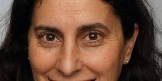 Telerehabilitation in Canada