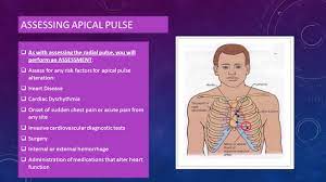 It is the most accurate because it is right astro produces helping to oligo but oligo produces inhibitory effects and micro just the isolation coating…so we can assume how miserable cns is in. Nur 111 Skill 5 3 Assessing Apical Pulse Ppt Video Online Download