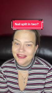 What to Do If You Have A Slit in The Middle of Your Nail