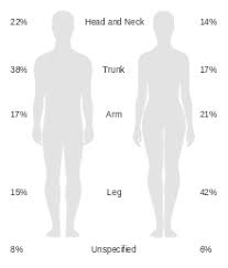 Melanoma Wikipedia