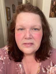 So I am having a bad flare up in my armpit.. and I feel pain going down  into my breast.. the flare up is just in my armpit... has anyone had that